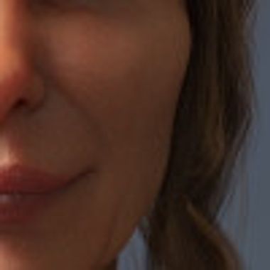 Bare-Faced-Cheek